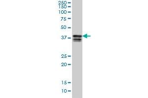 PCBP2 monoclonal antibody (M07), clone 5F12 Western Blot analysis of PCBP2 expression in K-562 . (PCBP2 antibody  (AA 1-362))