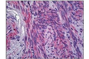 Human Uterus, Myometrium: Formalin-Fixed, Paraffin-Embedded (FFPE) (IFITM1 antibody)
