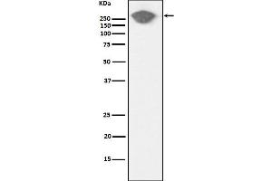Western Blotting (WB) image for anti-Fibronectin antibody (ABIN7607068)