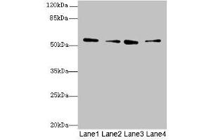 ERO1LB antibody  (AA 101-400)