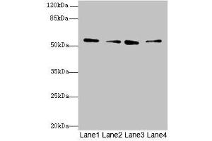 Western blot All lanes: ERO1B antibody at 3. (ERO1LB antibody  (AA 101-400))