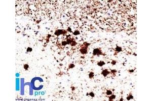 Formalin-fixed, paraffin-embedded human brain stained with Pgp9. (UCHL1 antibody)