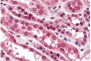 Human Kidney (formalin-fixed, paraffin-embedded) stained with ZNF292 antibody ABIN364490 at 10 ug/ml followed by biotinylated goat anti-rabbit IgG secondary antibody ABIN481713, alkaline phosphatase-streptavidin and chromogen. (ZNF292 antibody)