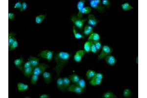 Immunofluorescence staining of MCF-7 cells with ABIN7142656 at 1:66, counter-stained with DAPI. (DCLRE1B antibody  (AA 345-493))