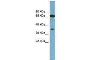 Image no. 1 for anti-Glyoxalase Domain Containing 4 (GLOD4) (AA 143-192) antibody (ABIN6741898) (GLOD4 antibody  (AA 143-192))