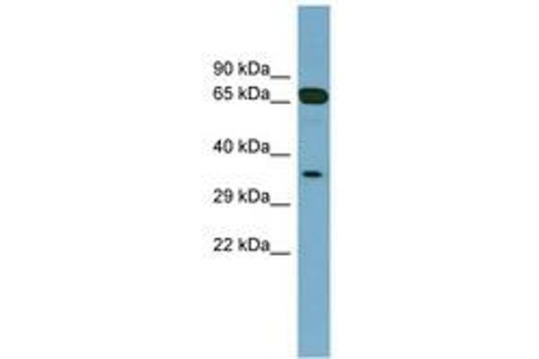 GLOD4 anticorps  (AA 143-192)
