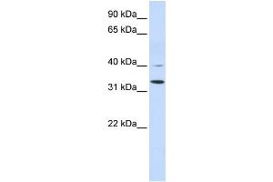WB Suggested Anti-CRYZ Antibody Titration:  0. (CRYZ antibody  (Middle Region))