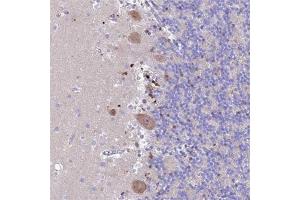 Immunohistochemical staining (Formalin-fixed paraffin-embedded sections) of human cerebellum with PRNP polyclonal antibody  shows moderate cytoplasmic positivity in Purkinje cells. (PRNP antibody)