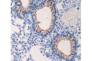 IHC-P analysis of lung tissue, with DAB staining. (CCL4 antibody  (AA 24-92))