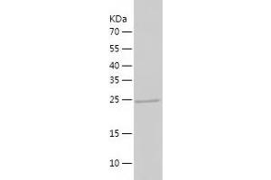 Asialoglycoprotein Receptor 2 Protein (ASGR2) (AA 80-311) (His tag)