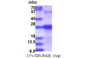 SDS-PAGE (SDS) image for Stromal Cell Derived Factor 2 (SDF2) (AA 19-211) protein (His tag) (ABIN5853737)