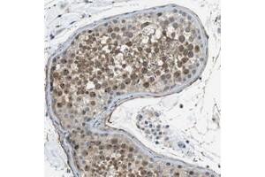 Immunohistochemical staining of human testis with ENTPD7 polyclonal antibody  shows moderate nuclear and cytoplasmic positivity in cells in seminiferus ducts at 1:20-1:50 dilution. (ENTPD7 antibody)