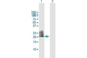 Western Blot analysis of CD160 expression in transfected 293T cell line by CD160 MaxPab polyclonal antibody.