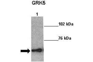 Sample Type: Lane 1:241 µg mouse left ventricle heart lysate Primary Antibody Dilution: 1:0000Secondary Antibody: Anti-rabbit-HRP Secondary Antibody Dilution: 1:0000 Color/Signal Descriptions: GRK5  Gene Name: Kathleen Gabrielson Submitted by: