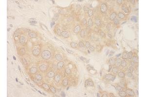 Immunohistochemistry (IHC) image for anti-SFRS Protein Kinase 2 (SRPK2) (AA 425-475) antibody (ABIN7449028) (SRPK2 antibody  (AA 425-475))