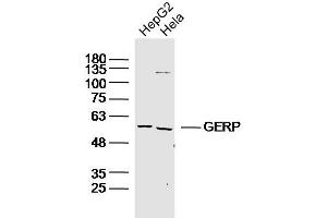 Lane 1: HepG2 lysates Lane 2: Hela lysates probed with GERP Polyclonal Antibody, Unconjugated  at 1:300 dilution and 4˚C overnight incubation.