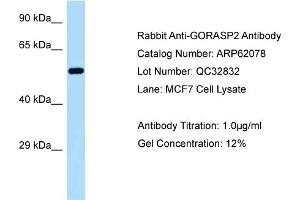 Western Blotting (WB) image for anti-Golgi Reassembly Stacking Protein 2, 55kDa (GORASP2) (C-Term) antibody (ABIN2789010) (GORASP2 antibody  (C-Term))