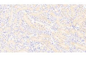 DAB staining on IHC-P;Samples: Mouse Kidney Tissue;Primary Ab: 20μg/ml Rabbit Anti-Mouse PDGFBB Antibody. (PDGF-BB Homodimer (AA 21-241) antibody)