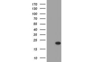 Western Blotting (WB) image for anti-Crystallin, alpha A (CRYAA) antibody (ABIN1498754)