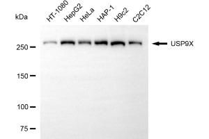 Western blotting analysis using USP9X antibody (ABIN7800739).