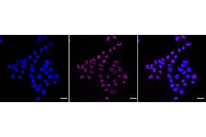 Immunocytochemical staining of HAP-1 cells with Nucleolin antibody (ABIN7799668), 1:1,000).