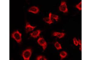 ABIN6269373 staining Hela by IF/ICC. (MAPK14 antibody)