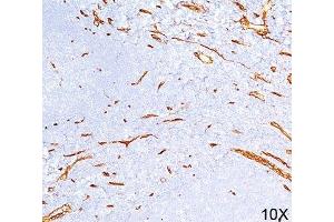 IHC testing of human tonsil (10X) stained with CD34 antibody (QBEnd/10). (CD34 antibody)