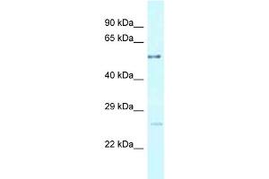 WB Suggested Anti-ENTPD3 Antibody Titration: 1. (ENTPD3 antibody  (C-Term))