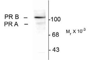 Image no. 1 for anti-Progesterone Receptor (PGR) (pSer294) antibody (ABIN227372) (Progesterone Receptor antibody  (pSer294))