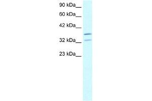 WB Suggested Anti-FOXL1 Antibody Titration:  2. (FOXL1 antibody  (N-Term))