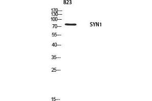 Western Blot (WB) analysis of 823 using SYN1 antibody. (SYN1 antibody)