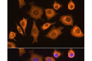 Immunofluorescence analysis of L929 cells using RIG-I / DDX58 Polyclonal Antibody at dilution of 1:100. (DDX58 antibody)