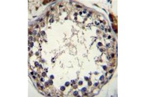 Formalin fixed and paraffin embedded human testis tissue stained with STRA8 Antibody (C-term) followed by peroxidase conjugation of the secondary antibody and DAB staining. (STRA8 antibody  (C-Term))