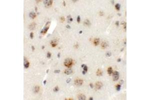 Immunohistochemical staining of mouse brain cells with AP3B2 polyclonal antibody  at 5 ug/mL. (AP3B2 antibody  (N-Term))