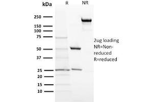 SDS-PAGE Analysis Purified ACTH Monoclonal Antibody (57). (POMC antibody  (N-Term))