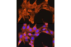 Immunofluorescence (IF) image for anti-phosphofructokinase, Muscle (PFKM) (AA 501-780) antibody (ABIN6145488)