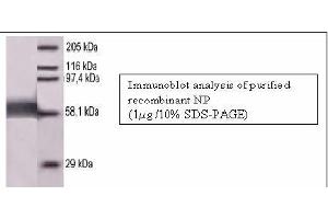Image no. 1 for anti-Measles Virus Nucleoprotein (MV N) antibody (ABIN346974) (Measles Virus Nucleoprotein (MV N) antibody)