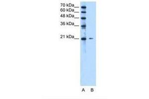 Image no. 1 for anti-Chromosome 20 Open Reading Frame 24 (C20ORF24) (N-Term) antibody (ABIN321585) (C20ORF24 antibody  (N-Term))