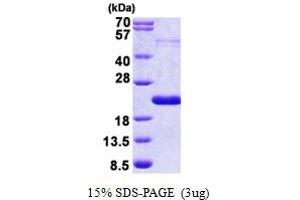 SDS-PAGE (SDS) image for Thyroid Hormone Responsive (THRSP) (AA 1-146) protein (His tag) (ABIN5853002) (THRSP Protein (AA 1-146) (His tag))
