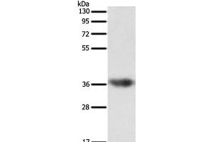 Western Blot analysis of Human liver cancer tissue using SULT1E1 Polyclonal Antibody at dilution of 1:500 (SULT1E1 antibody)