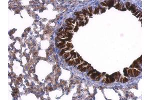 Immunohistochemistry (IHC) image for anti-GDP Dissociation Inhibitor 1 (GDI1) antibody (ABIN2855146)