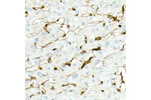 Immunohistochemistry of paraffin-embedded Human liver (positive control antibody staining, clone 55k-2) using Fascin/FSCN1 antibody (ABIN7267142) at dilution of 1:100 (40x lens). (Fascin antibody)