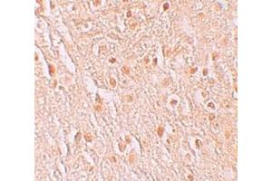 Immunohistochemistry (IHC) image for anti-Pigeon Homolog (PION) (C-Term) antibody (ABIN1030587) (GSAP antibody  (C-Term))