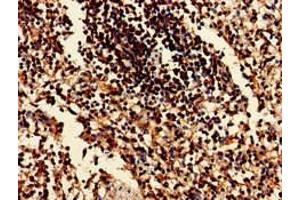 Immunohistochemistry of paraffin-embedded human spleen tissue using ABIN7152137 at dilution of 1:100 (EIF2AK1 antibody  (AA 1-86))