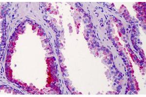 Human Prostate: Formalin-Fixed, Paraffin-Embedded (FFPE) (ST14 antibody  (AA 10-59))
