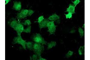Image no. 2 for anti-Deoxythymidylate Kinase (Thymidylate Kinase) (DTYMK) antibody (ABIN1497923) (DTYMK antibody)