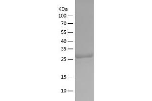 Western Blotting (WB) image for TP53 induced glycolysis regulatory phosphatase (TIGAR) (AA 2-270) protein (His tag) (ABIN7281997) (TIGAR Protein (AA 2-270) (His tag))