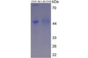 Image no. 2 for Amyloid beta 1-40 (Abeta 1-40) peptide (Ovalbumin) (ABIN5666069) (Amyloid beta 1-40 (Abeta 1-40) peptide (Ovalbumin))