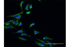 Immunofluorescence of purified MaxPab antibody to HSD17B10 on HeLa cell. (HSD17B10 antibody  (AA 1-261))