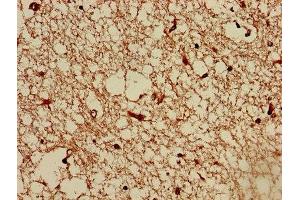 Immunohistochemistry of paraffin-embedded human brain tissue using ABIN7173087 at dilution of 1:100 (TMEM161B antibody  (AA 1-487))